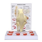 Anatomie model knie meniscus (17x6x15 cm)