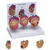 Anatomie model hart, 3 stuks mini