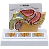 Anatomie model bekken man met prostaat, doorsnede