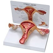 Anatomie model baarmoeder (23x16x6 cm)