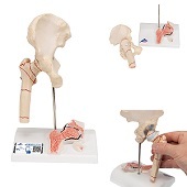 Anatomie model heupfractuur en artrose