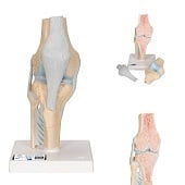 Anatomie model knie (3-delig, doorsnede)