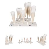 Anatomie modellen tanden, 5 stuks