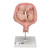 Anatomie model zwangerschap, tweelingfoetussen (normale positie)