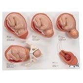 Anatomie model geboorte (complete serie van 5 modellen)