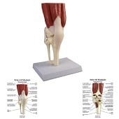 Anatomie model kniegewricht met spieren