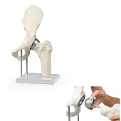 Anatomie model heupgewricht met prothese