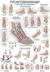 Anatomie poster voet en voetaandoeningen (Duits/Engels/Latijn, papier, 50x70 cm) + ophangsysteem