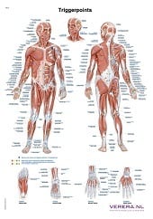 Anatomie poster triggerpoints (Nederlands/Latijn, papier, 50x70 cm) + ophangsysteem