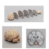 Anatomie model hersenen, frontale doorsnedes
