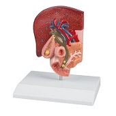 Anatomie model galstenen (14x10x19 cm)