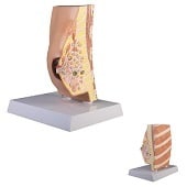 Anatomie model borstdwarsdoorsnede met ziekten