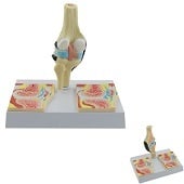 Anatomie model knie met reuma