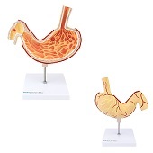 Anatomie model maag met maagzweer (23x19x2 cm)