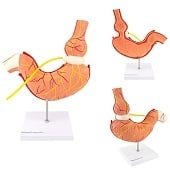 Anatomie model maag met maagband (2-delig, 26x21x7 cm)