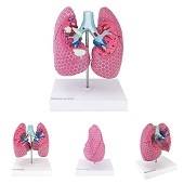 Anatomie model longen met longziekten