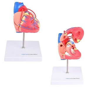 Anatomie model hart met bypasses, 2-delig, 16x14x12 cm